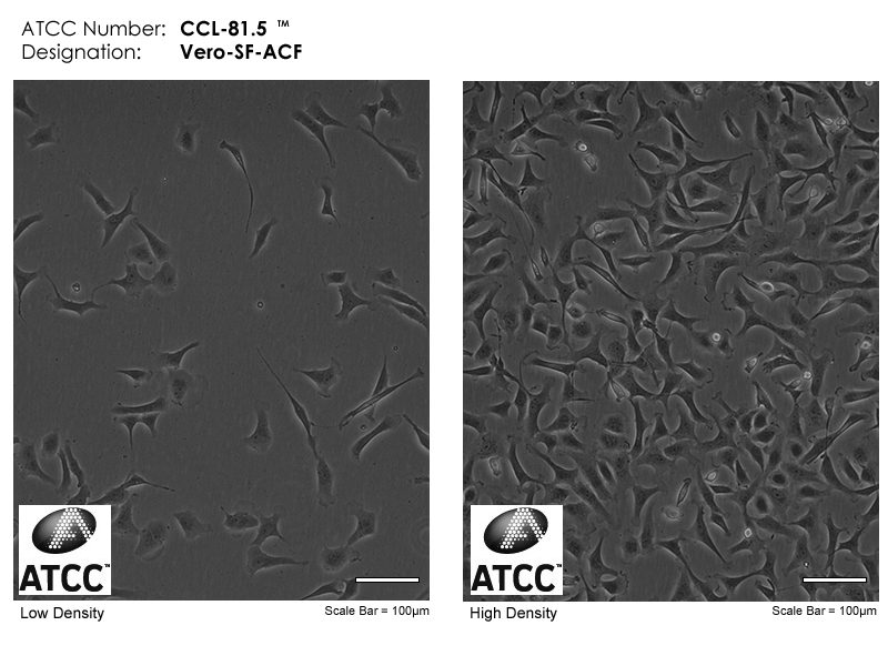 ATCC CCL-81.5 Cell Micrograph