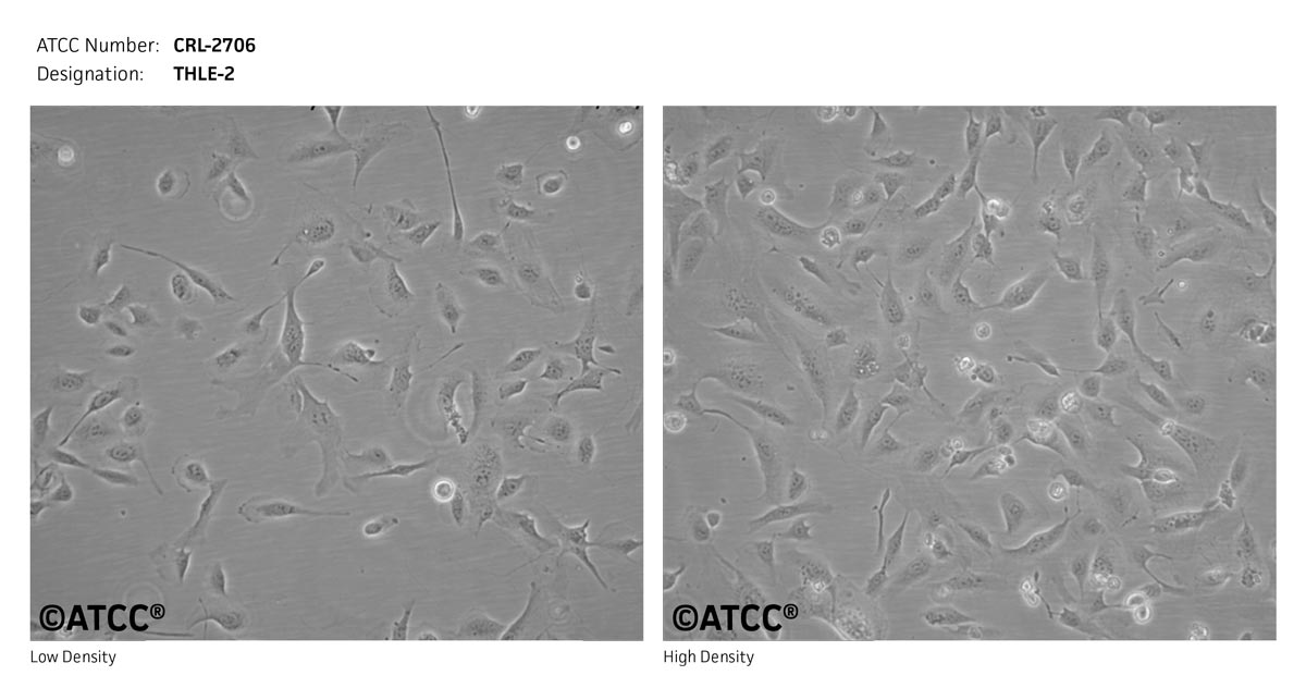 ATCC CRL-2706 Cell Micrograph