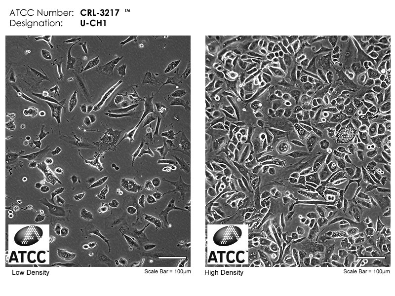Cell micrograph of ATCC CRL-3217 ( U-CH1 human chordoma)
