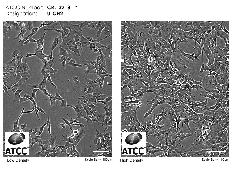 Cell micrograph of ATCC CRL-3218 U-CH2 (human chordoma)
