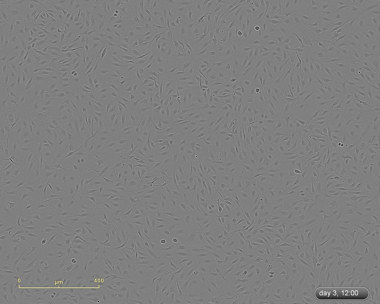 CRL-4054 Cell Micrograph