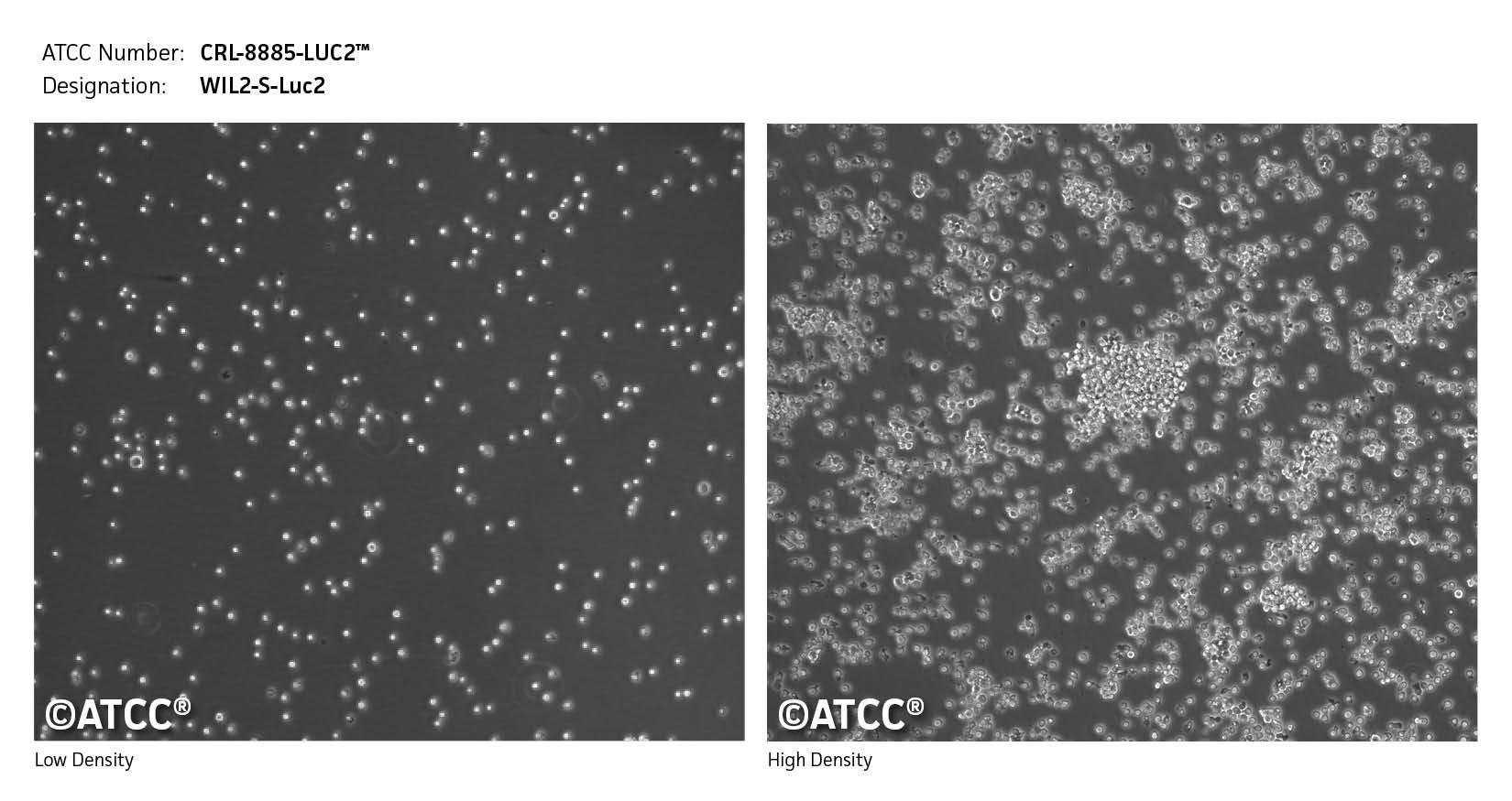 Cell Micrograph CRL-8885-LUC2