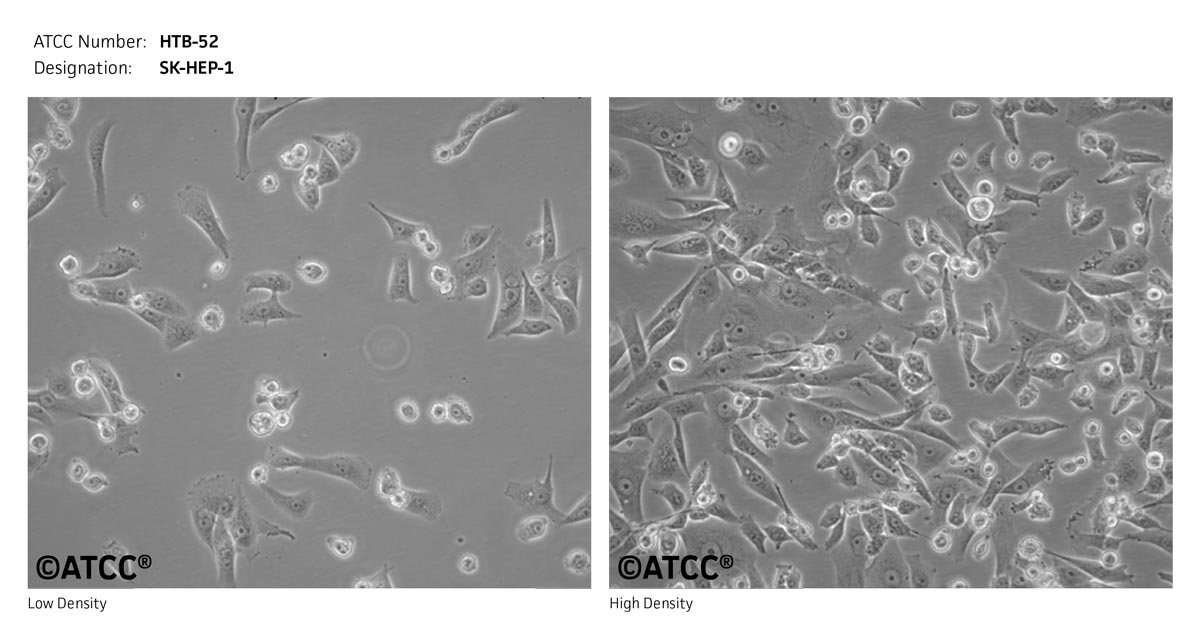 ATCC HTB-52 Cell Micrograph
