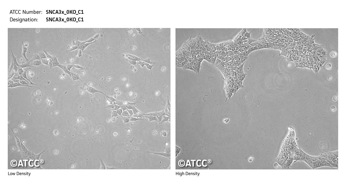 Cell micrograph SNCA3x_0KO_C1