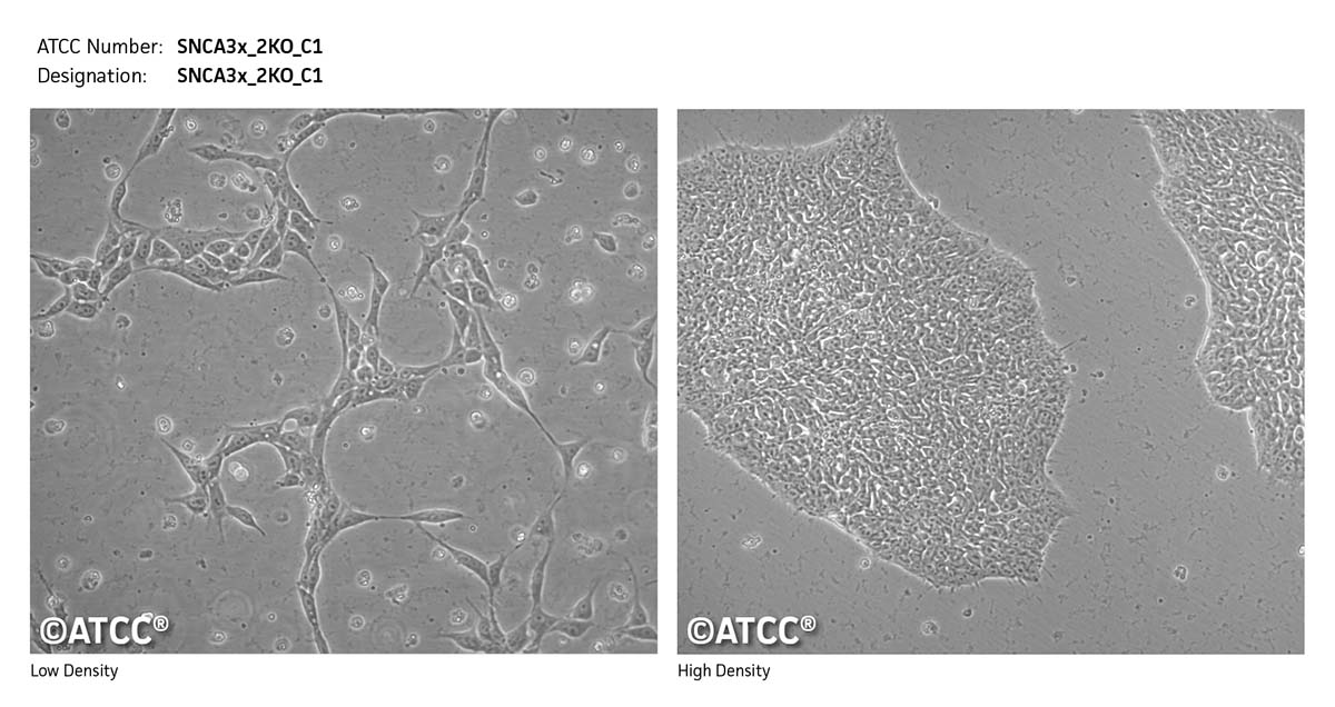 Cell Micrograph SNCA3x_2KO_C1