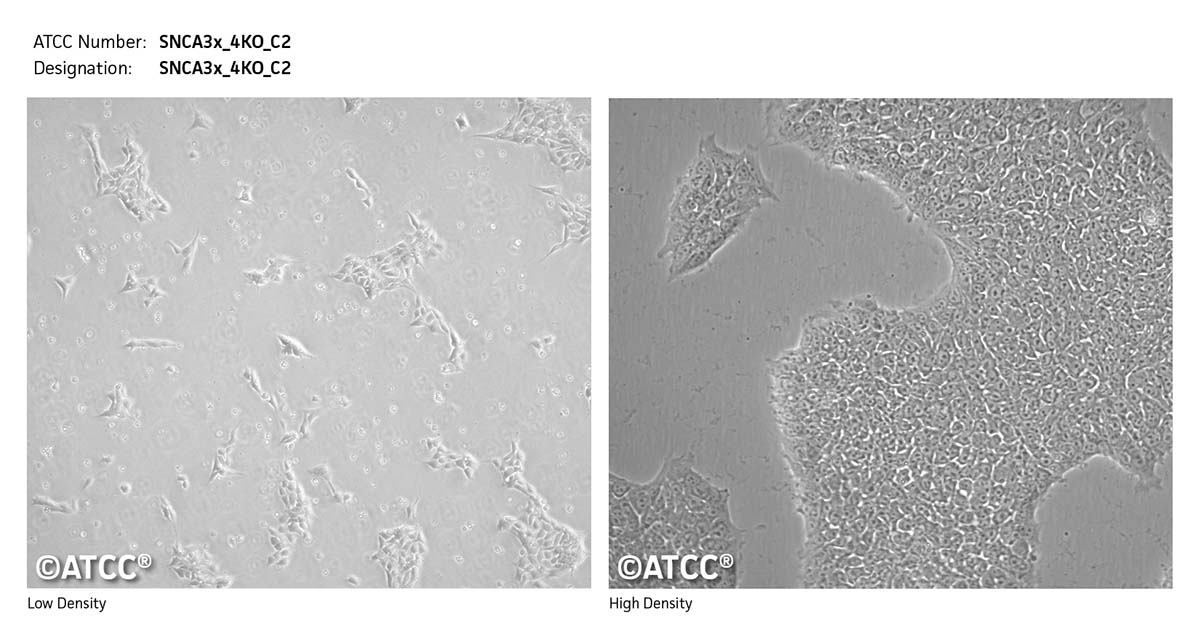 Cell micrograph SNCA3x_4KO_C2