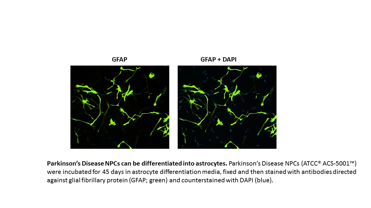 Parkinsons NPC Astrocyte Expression