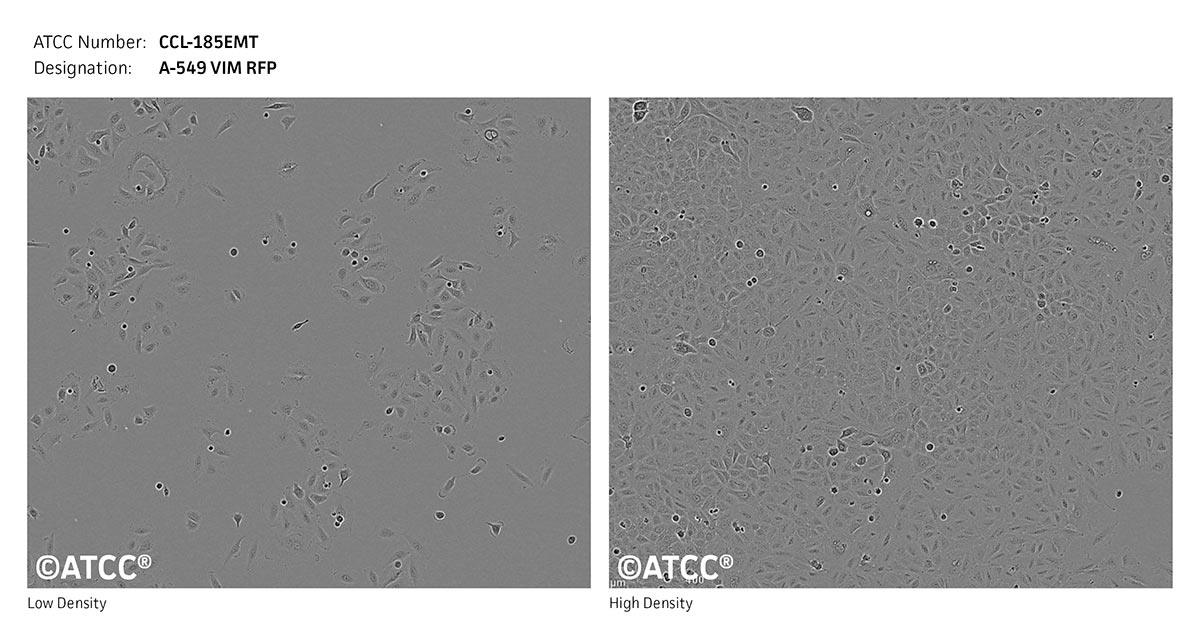 ATCC CCL-185EMT, A-549 VIM RFP Cell Micrograph