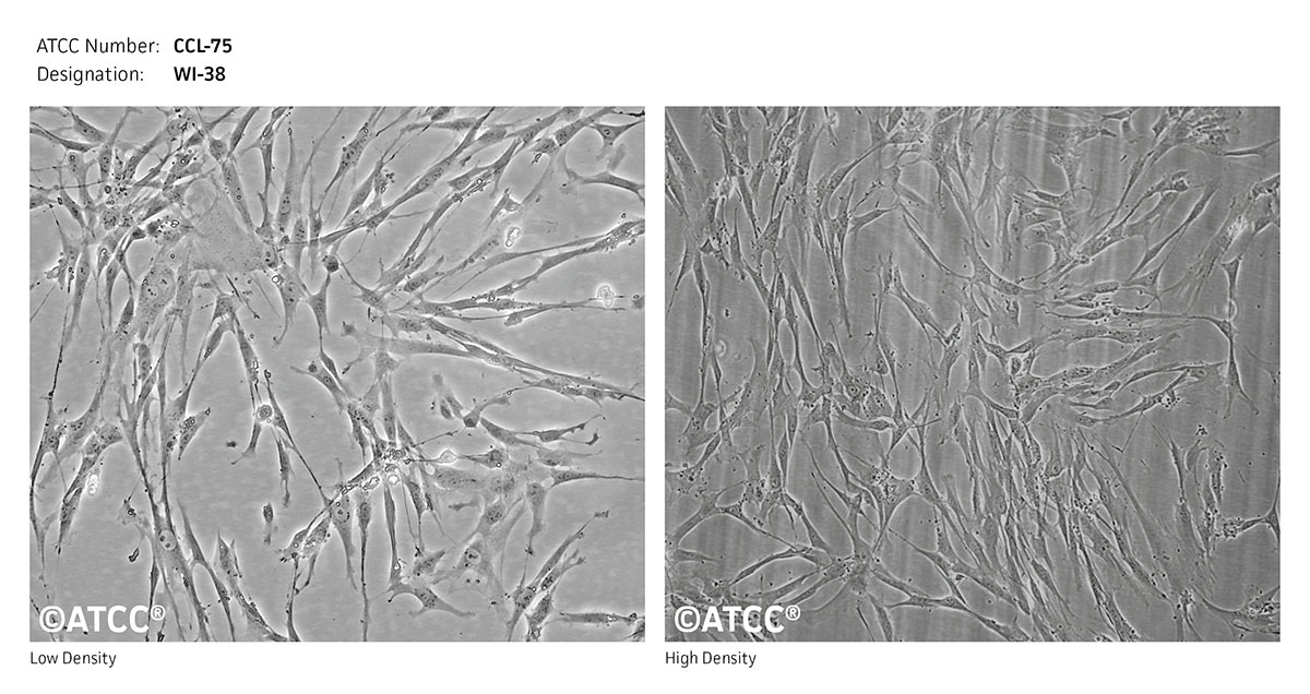 ATCC CCL-75 Cell Micrograph