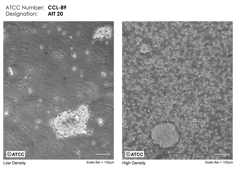 AtT-20 - CCL-89 | ATCC