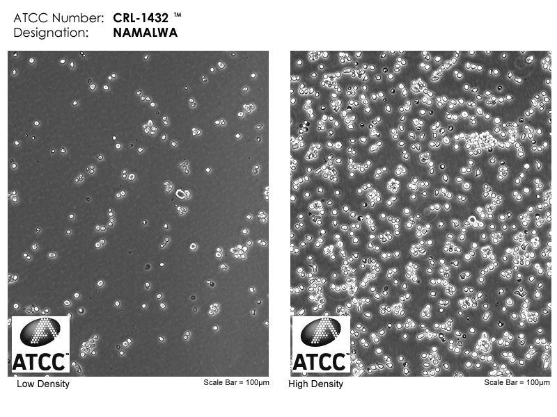CRL-1432 Micrograph