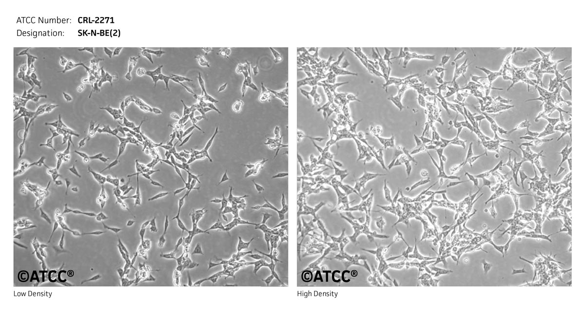 ATCC CRL-2271 Cell Micrograph