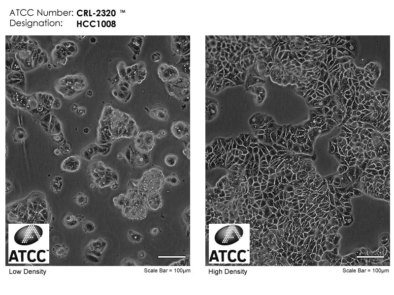ATCC CRL-2320 Cell Micrograph