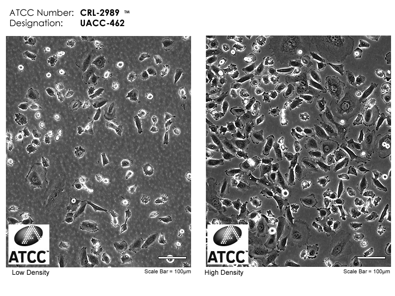 ATCC CRL-2989 Cell Micrograph