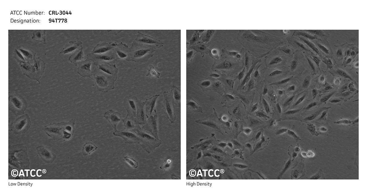 94T778  ATCC CRL-3044 Cell Micrograph