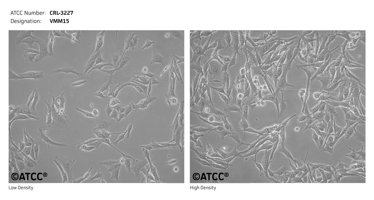 ATCC CRL-3227 Cell Micrograph