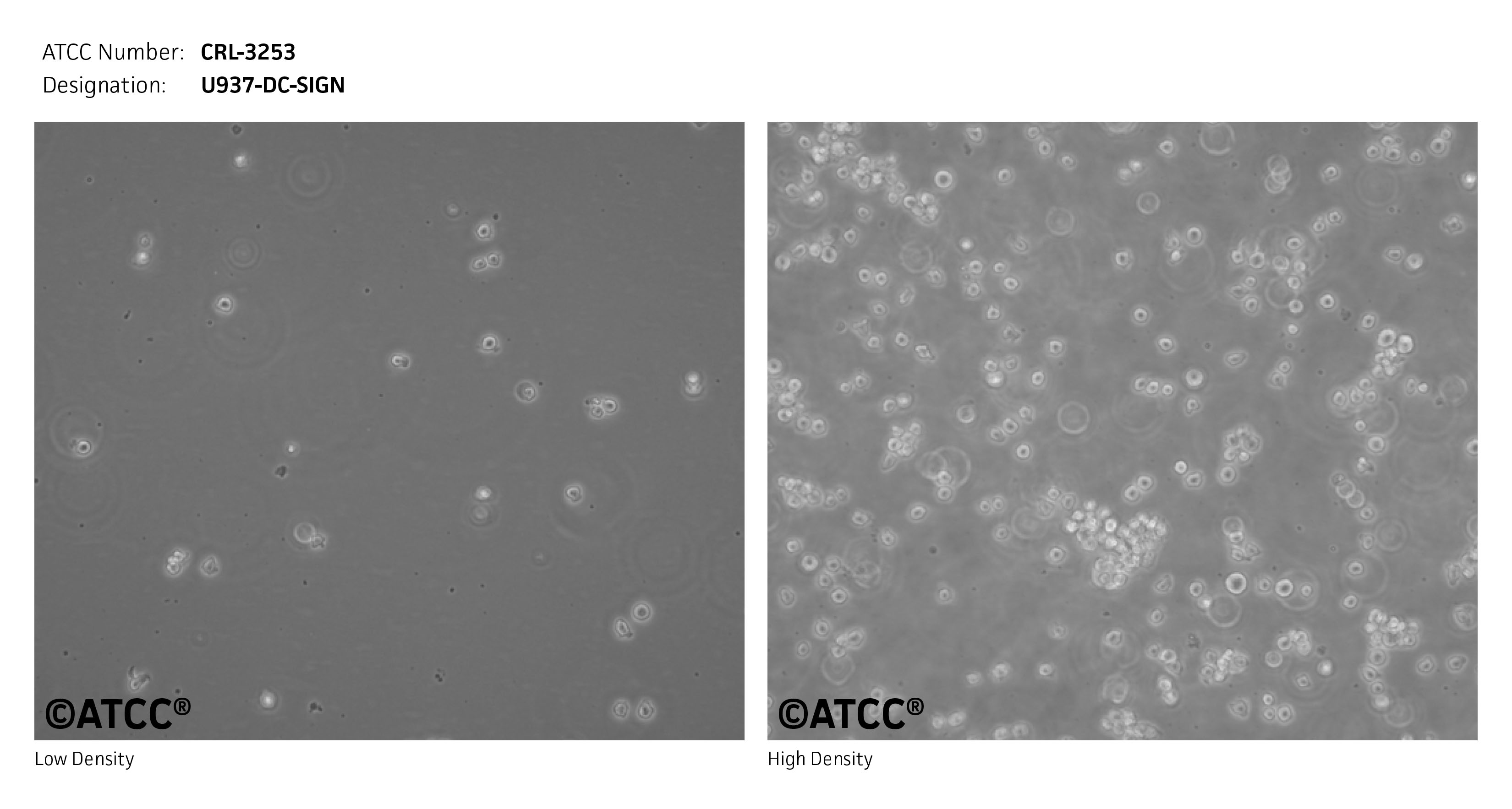 Cell Micrograph of U937-DC-SIGN 