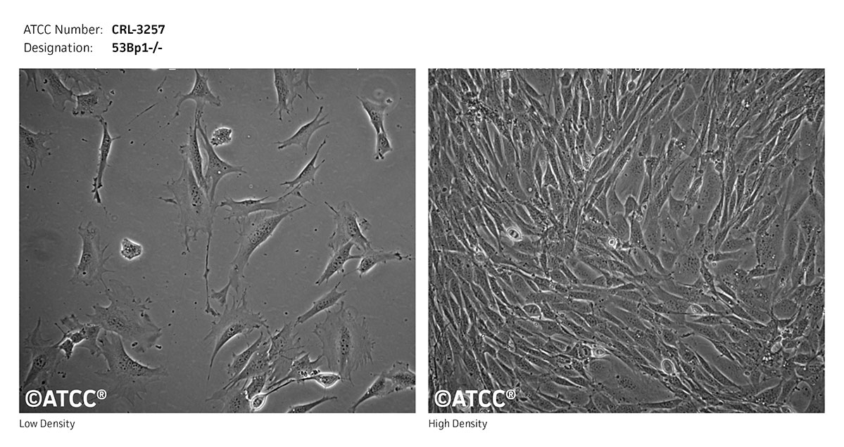 Cell Micrograph of 53Bp1-/- ATCC CRL-3257 cells