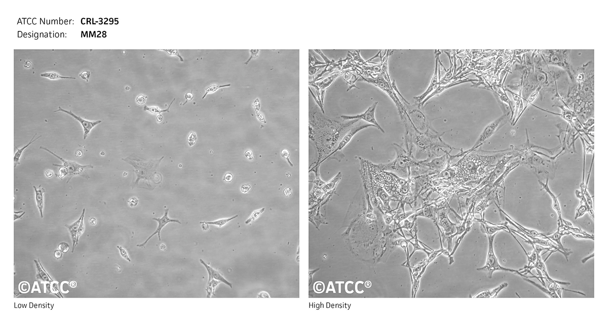 MM28, ATCC CRL-3295 Image