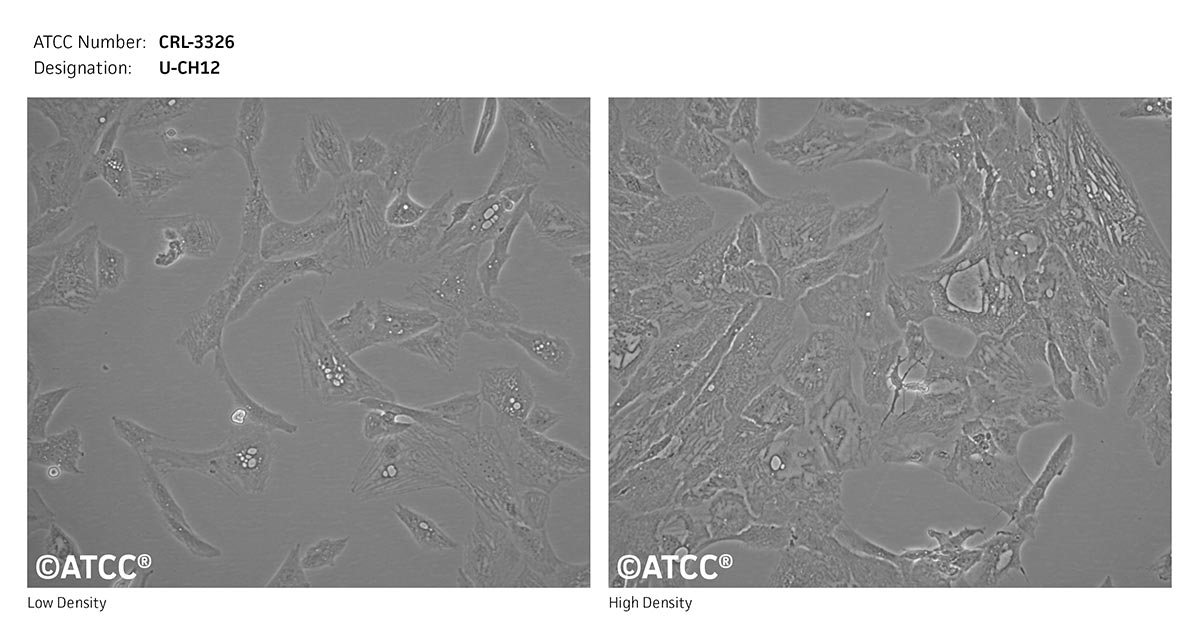 Cell Micrograph of U-CH12, ATCC CRL-3326