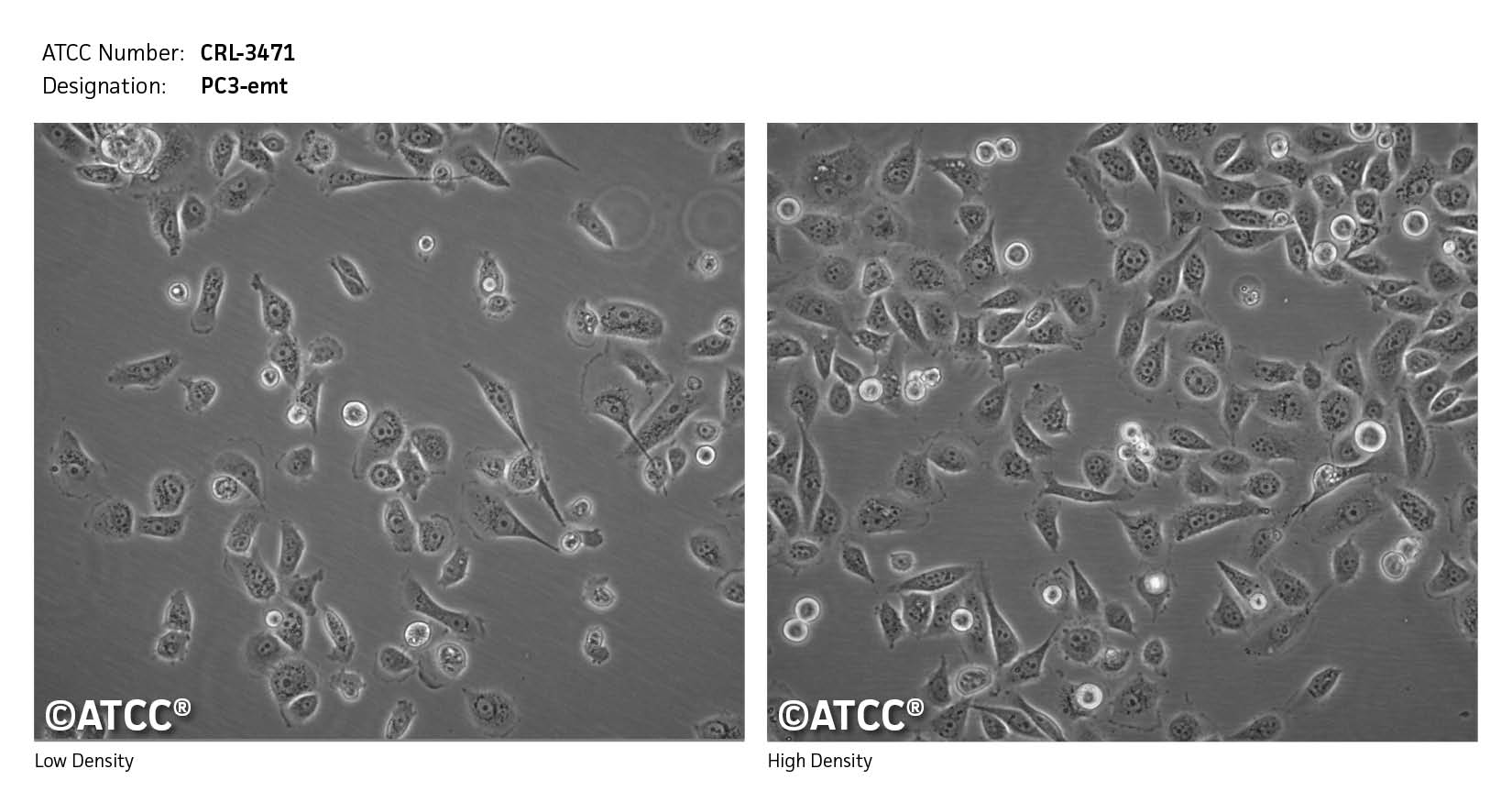 ATCC CRL-3471 Cell Micrograph