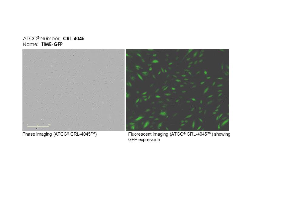 ATCC CRL-4045 Cell Micrograph