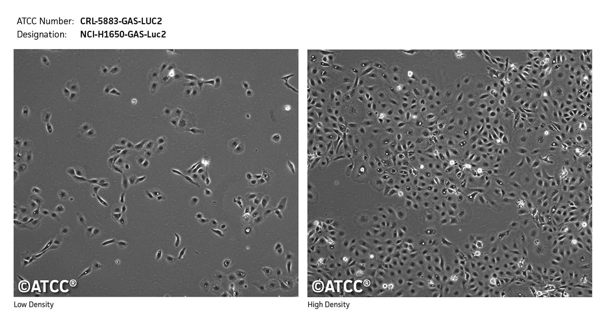 Cell micrograph CRL-5883-GAS-LUC2