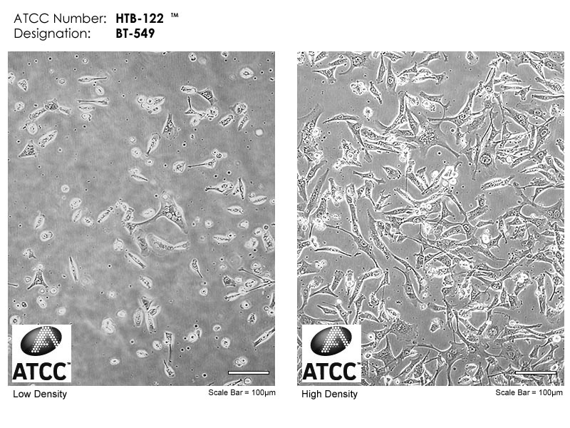 ATCC HTB-122 Micrograph