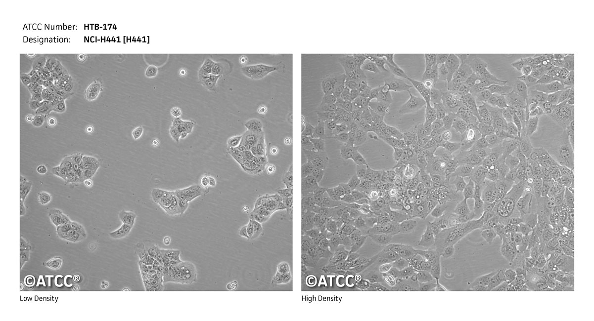 NCI-H441 [H441] - HTB-174 | ATCC