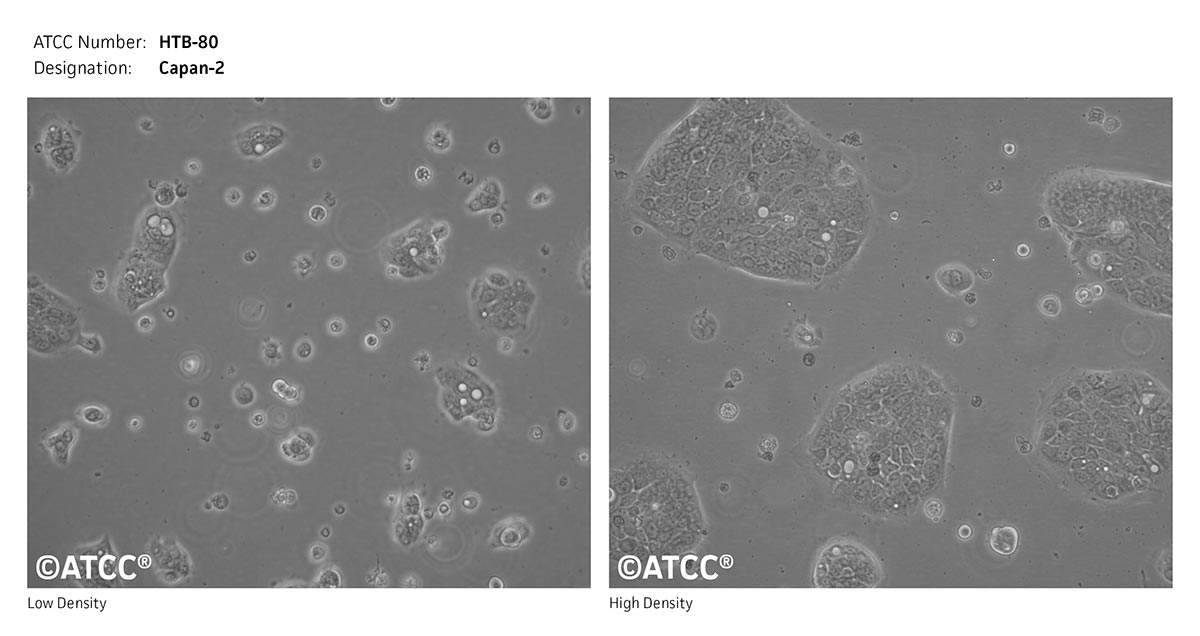 Cell Micrograph of ATCC HTB-80, Capan-2