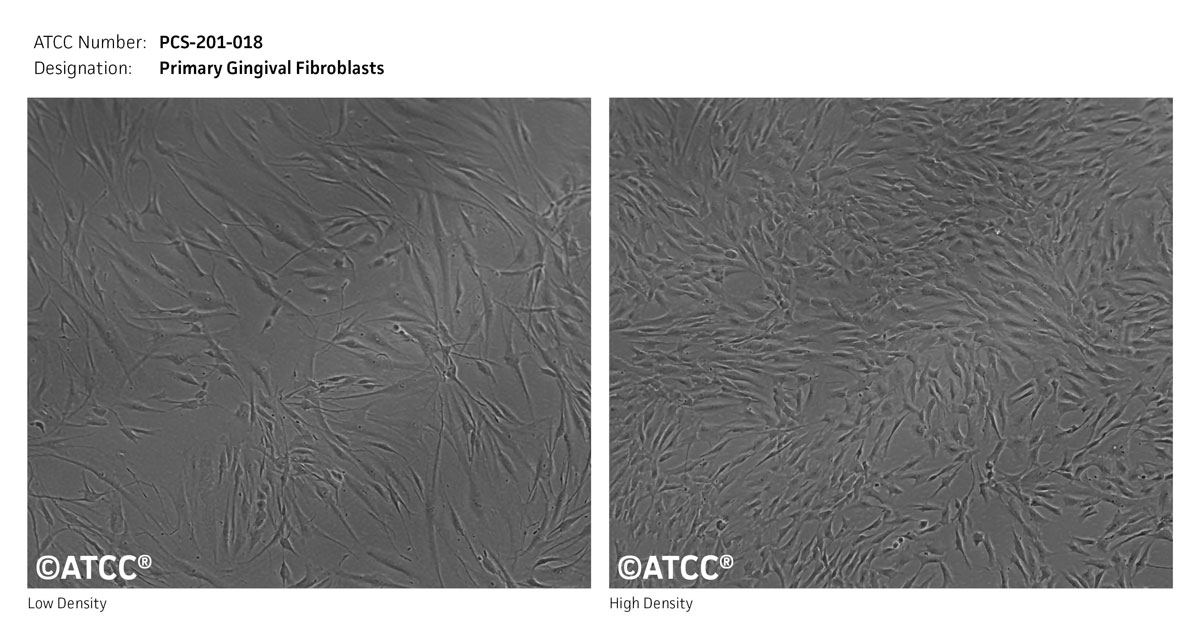 Cell Micrograph of ATCC PCS-201-018 cells