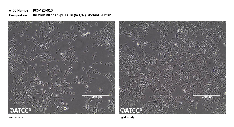 Cell Micrograph of ATCC PCS-420-010