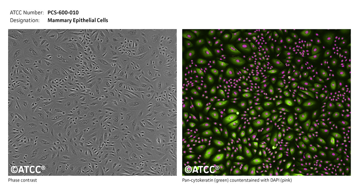 Mammary epithelial cells with phased contrast, ATCC PCS-600-010