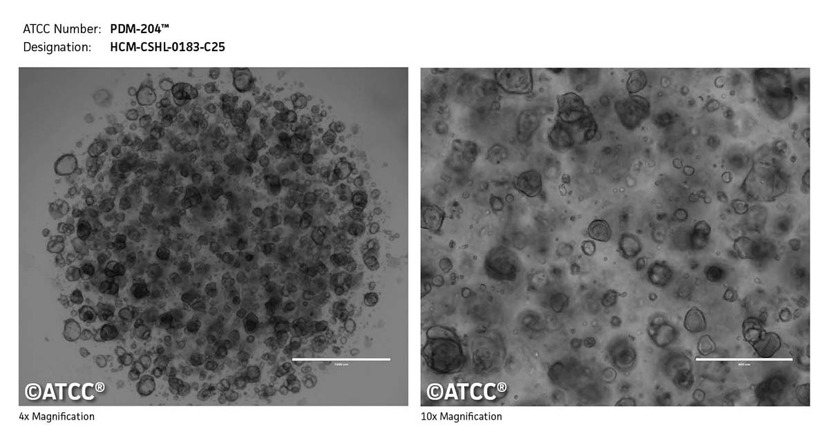 Cell micrograph of PDM-204