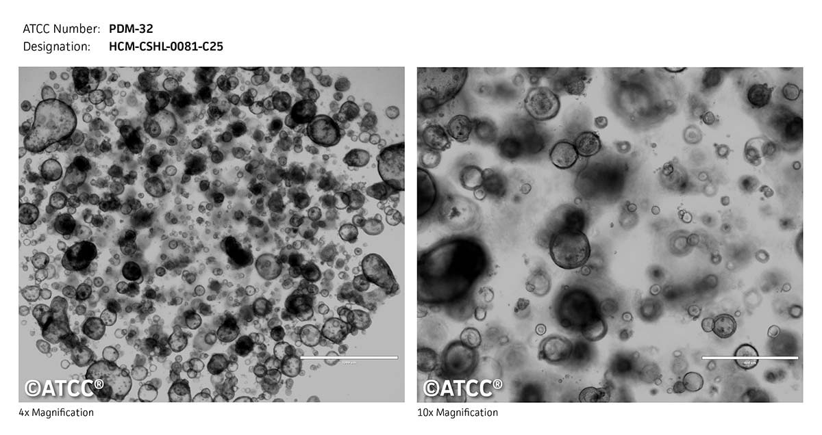 ATCC PDM-32 Cell Micrograph