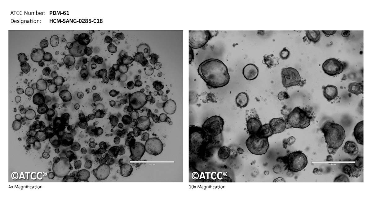 ATCC PDM-61 Cell Micrograph