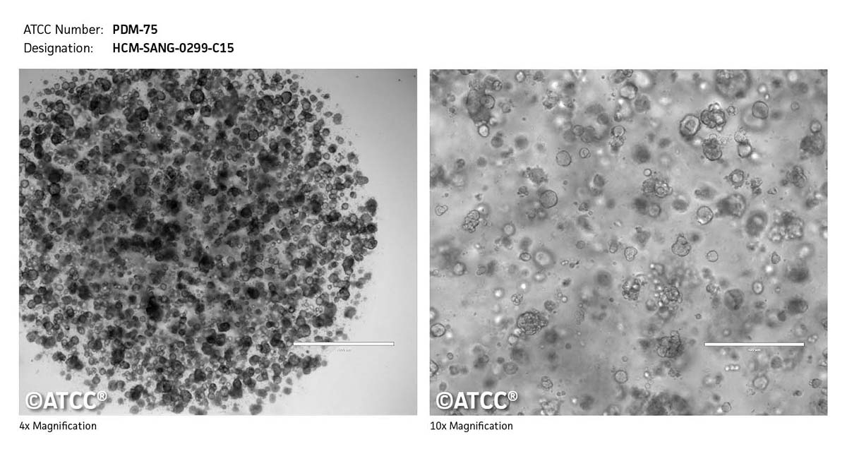 Cell micrograph of ATCC PDM-75