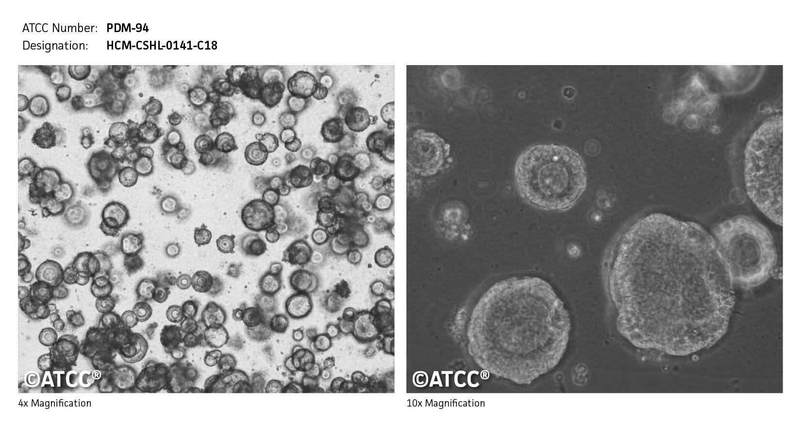 ATCC PDM-94 Cell Micrograph