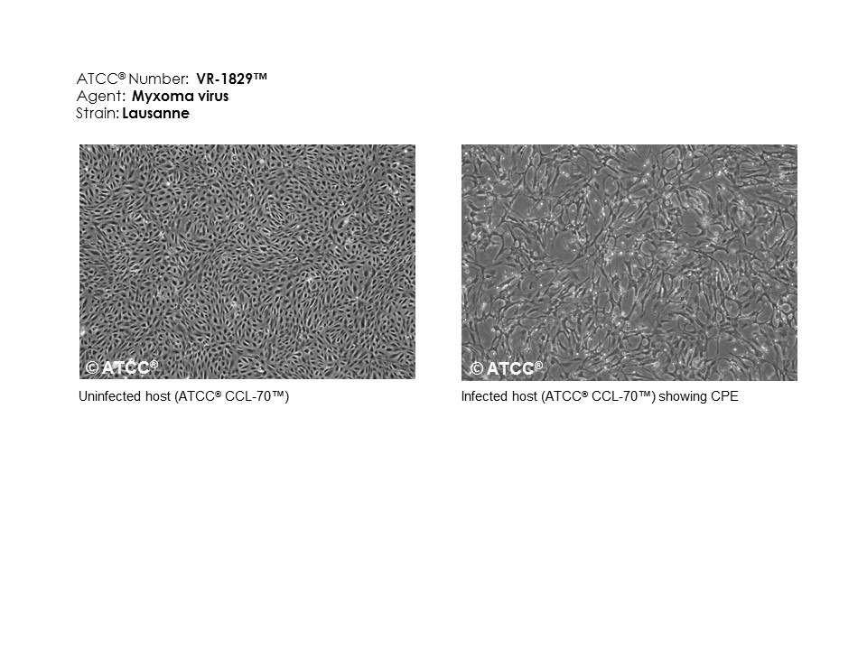 Cell Micrograph of ATCC VR-1829 