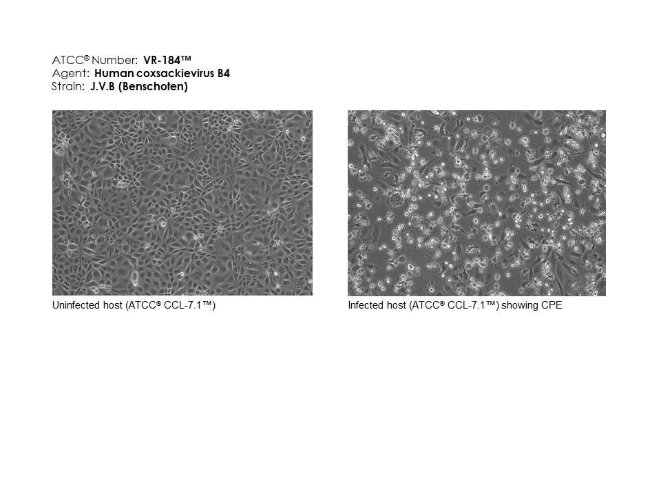 ATCC VR-184 images