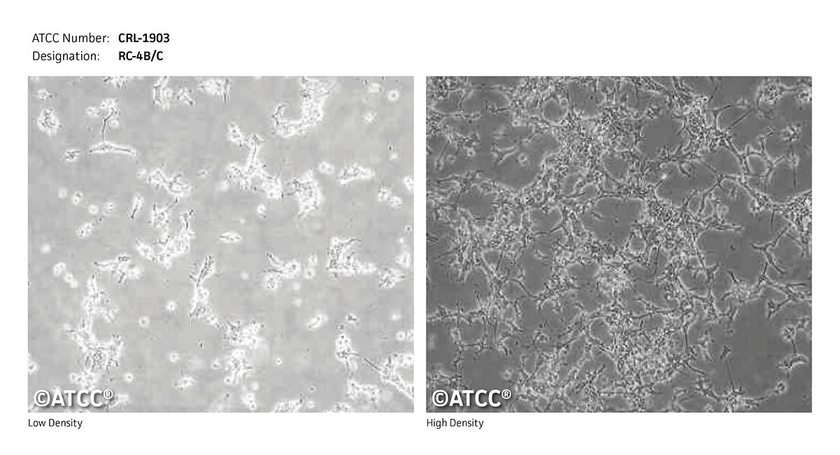 Rc 4b C Atcc Crl 1903 Rattus Norvegicus Pituitary Anteri